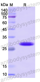 Recombinant Human KARS1 Protein, N-His