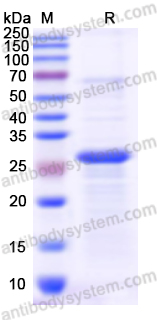 Recombinant Human RAGE/AGER Protein, N-His