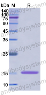 Recombinant Human PCOLCE Protein, N-His