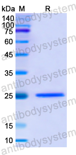 Recombinant Human PDK1 Protein, N-His
