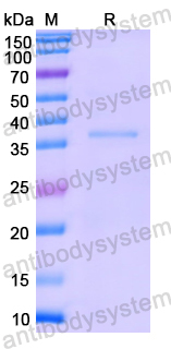 Recombinant Human PDK2 Protein, N-His