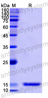 Recombinant Human PGM5 Protein, N-His