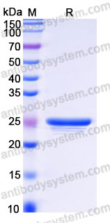 Recombinant Human PMVK Protein, N-His
