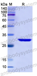 Recombinant Human PRKD1 Protein, N-His
