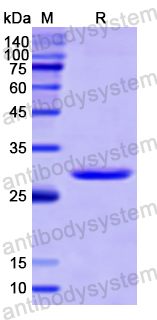 Recombinant Human PLEC Protein, N-His