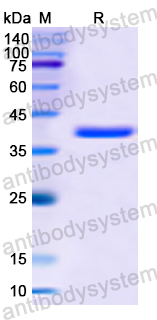 Recombinant Human PCM1 Protein, N-GST