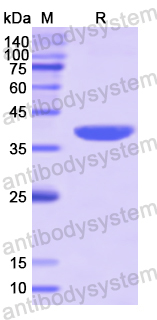 Recombinant Human PON2 Protein, N-His
