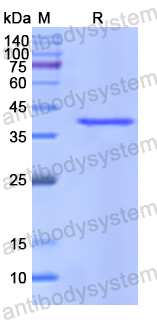 Recombinant Human PON3 Protein, N-His