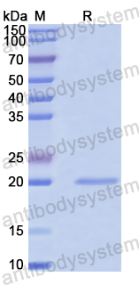 Recombinant Human PTGES3/P23 Protein, N-His