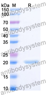 Recombinant Human PTPRR Protein, N-His
