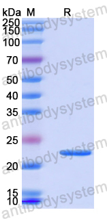 Recombinant Human RABEP1 Protein, N-His-SUMO