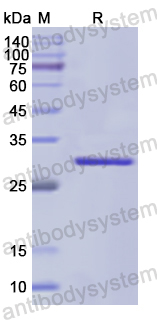 Recombinant Human ERBB4 Protein, N-His
