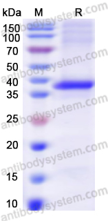 Recombinant Human IRF4 Protein, N-His