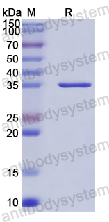 Recombinant Human RPS6KA2 Protein, N-His