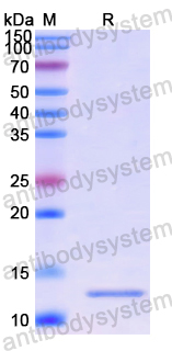 Recombinant Human TMED2 Protein, N-His