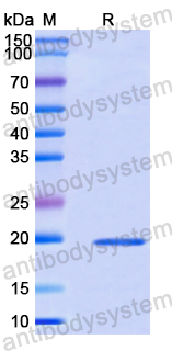 Recombinant Human PCBP2 Protein, N-His