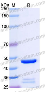 Recombinant Human RHEB Protein, N-GST