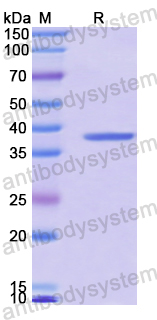 Recombinant Human TOMM20 Protein, N-GST & C-His