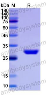 Recombinant Human SHP/NR0B2 Protein, N-His
