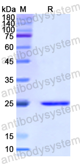 Recombinant Human TGFBI Protein, N-His
