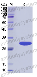 Recombinant Human TRADD Protein, N-His