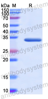 Recombinant Human MAPRE1 Protein, N-His