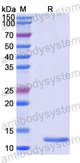 Recombinant Human ELF2 Protein, N-His