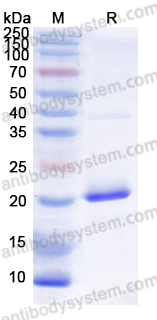 Recombinant Human SCN9A Protein, N-His