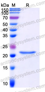 Recombinant Human HSPB2 Protein, C-His