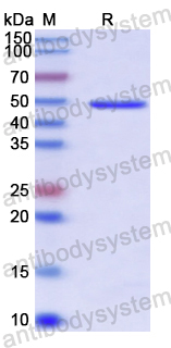 Recombinant Human SEPTIN7 Protein, N-His