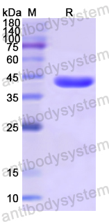 Recombinant Human ADRM1 Protein, N-His