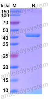 Recombinant Human LAMA4 Protein, N-His