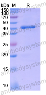 Recombinant Human ASIC2 Protein, N-His