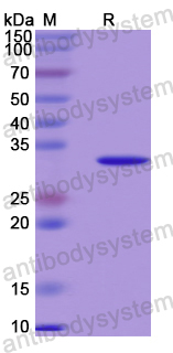 Recombinant Human CAMK4 Protein, N-His