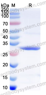 Recombinant Human MAP3K11 Protein, N-His