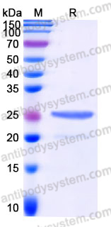 Recombinant Human CTF1 Protein, N-His