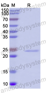 Recombinant Human TBR1 Protein, N-His