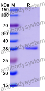 Recombinant Human HIF1A Protein, N-His