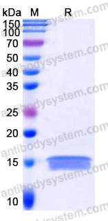 Recombinant Human MIA Protein, C-His