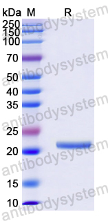 Recombinant Human NDUFA5 Protein, N-His-SUMO