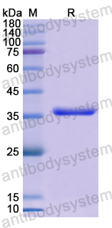 Recombinant Human KYNU Protein, N-His