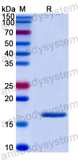 Recombinant Human UGCG Protein, N-His