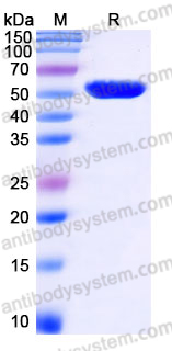 Recombinant Human UBE2S Protein, N-GST