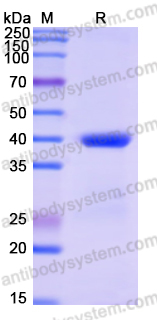 Recombinant Human KYAT1 Protein, N-His