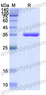 Recombinant Human MEP1A Protein, N-His