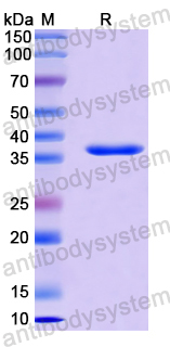 Recombinant Human PTPRO Protein, N-His