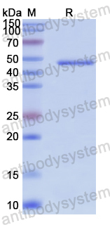 Recombinant Human UGP2 Protein, N-His