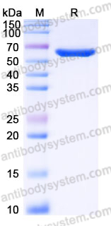 Recombinant Human PFKFB3 Protein, N-His