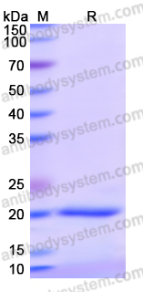 Recombinant Human CSPP1 Protein, N-His