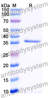 Recombinant Human INF2 Protein, N-His
